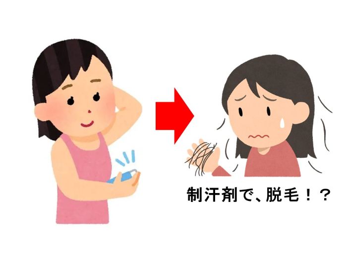 円形脱毛症　病院